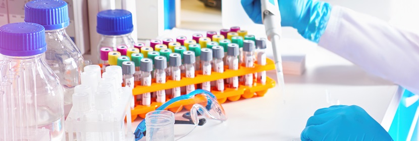 硝酸鑭檢測(cè)